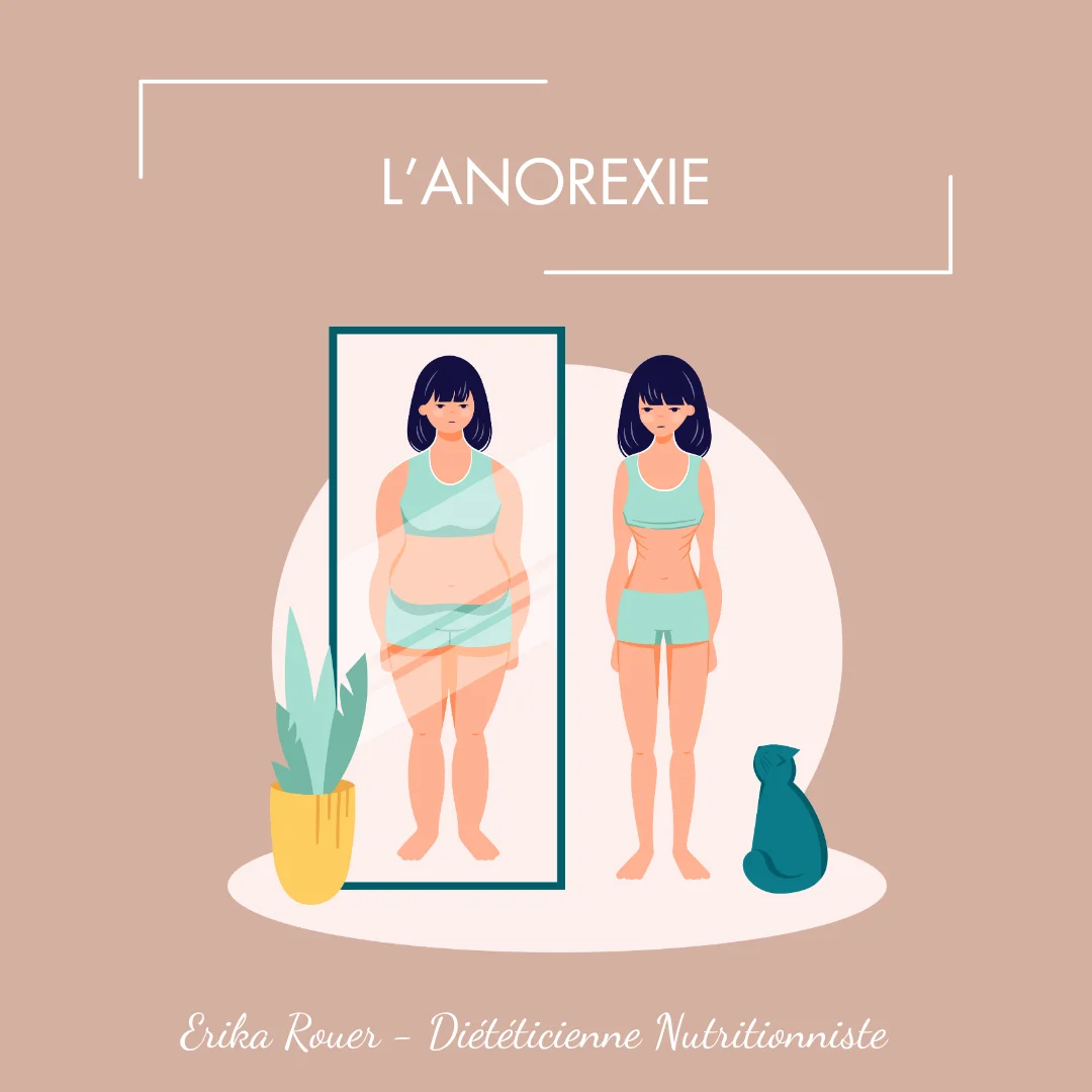 L'anorexie mentale et la prise en charge de cette pathologie